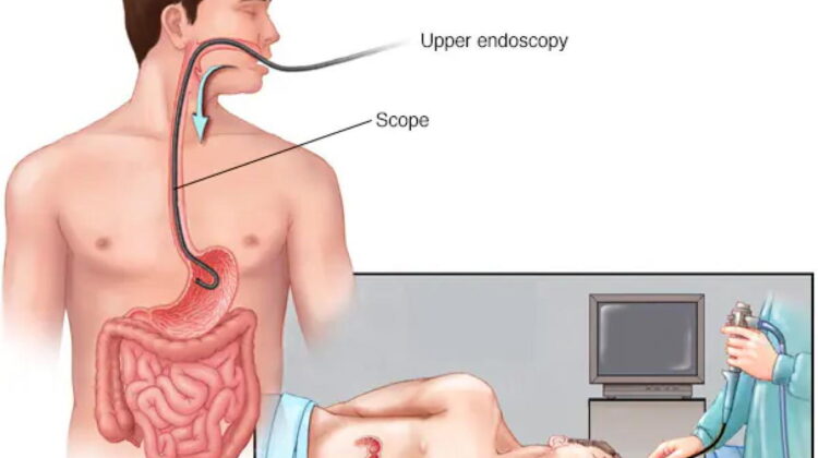 EGD Techniques and Their Applications in Diagnosis