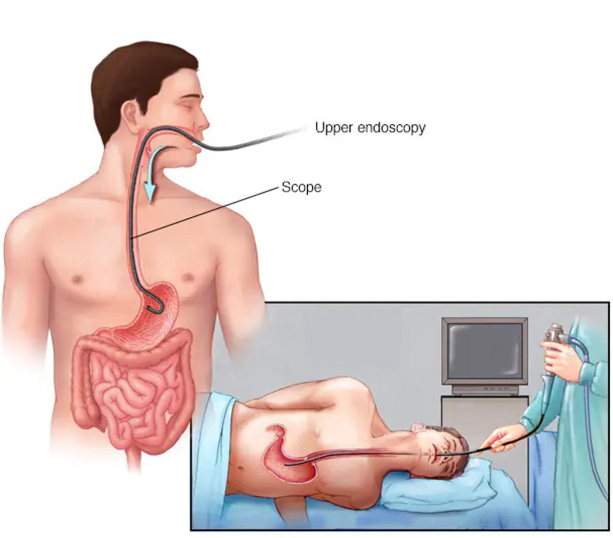 EGD Techniques and Their Applications in Diagnosis